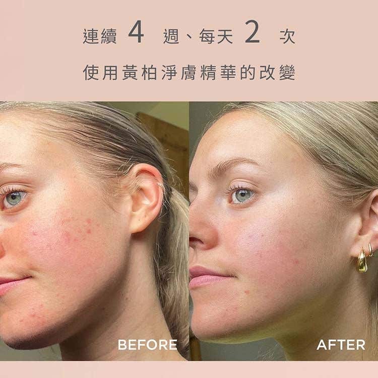 Neal's Yard Remedies 黃柏淨膚導入精華 25ml 成效圖