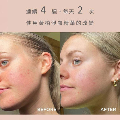 Neal's Yard Remedies 黃柏淨膚導入精華 25ml 成效圖